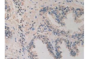IHC-P analysis of Human Prostate Gland Tissue, with DAB staining. (CACYBP Antikörper  (AA 2-228))