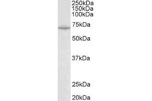 Antibody (0. (SLC6A8 Antikörper  (Internal Region))