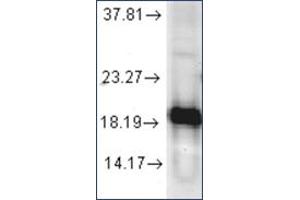 Image no. 1 for anti-Superoxide Dismutase 1, Soluble (SOD1) antibody (ABIN264854) (SOD1 Antikörper)