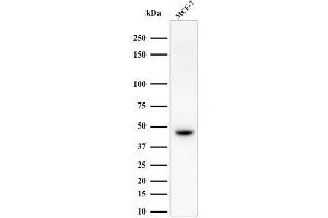 Western Blot Analysis of MCF-7 cell lysate using Cytokeratin, HMW Mouse Monoclonal Antibody (34BE12). (Cytokeratin 2 Antikörper)