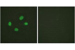 Immunofluorescence analysis of HeLa cells, using Chk2 (Phospho-Thr383) Antibody. (CHEK2 Antikörper  (pThr383))