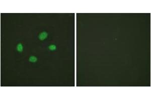Immunofluorescence analysis of HeLa cells, using Chk2 (Phospho-Thr383) Antibody. (CHEK2 Antikörper  (pThr383))