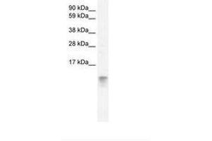 Image no. 2 for anti-Fatty Acid Binding Protein 3, Muscle and Heart (FABP3) (AA 46-95) antibody (ABIN202026) (FABP3 Antikörper  (AA 46-95))