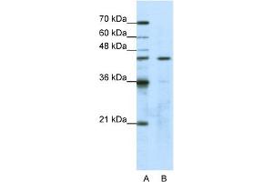 WB Suggested Anti-GTPBP9 Antibody Titration:  1. (OLA1 Antikörper  (N-Term))