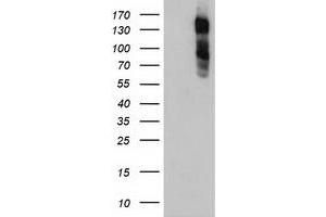 HEK293T cells were transfected with the pCMV6-ENTRY control (Left lane) or pCMV6-ENTRY ENPEP (Right lane) cDNA for 48 hrs and lysed. (ENPEP Antikörper)