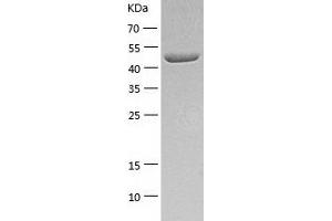 Western Blotting (WB) image for Aldehyde Dehydrogenase 3 Family, Member A1 (ALDH3A1) (AA 1-453) protein (His tag) (ABIN7121774)