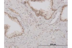 Immunoperoxidase of monoclonal antibody to FOXO3A on formalin-fixed paraffin-embedded human prostate. (FOXO3 Antikörper  (AA 361-460))