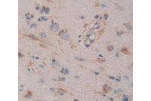Used in DAB staining on fromalin fixed paraffin- embedded brain tissue (MPI Antikörper  (AA 2-423))