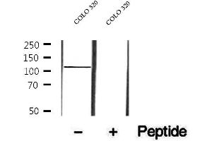 Western blot analysis of extracts of COLO 320 cells, using p107 antibody. (p107 Antikörper  (C-Term))
