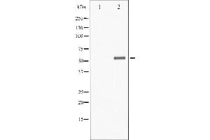 Western blot analysis of Chk1 phosphorylation expression in 293 whole cell lysates,The lane on the left is treated with the antigen-specific peptide.