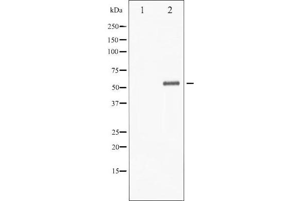 CHEK1 Antikörper  (pSer301)