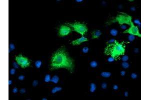 Immunofluorescence (IF) image for anti-Katanin P80 (WD Repeat Containing) Subunit B 1 (KATNB1) antibody (ABIN1498987) (KATNB1 Antikörper)