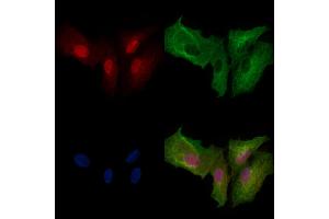 Phospho-PFKFB3 (Ser461) Antibody staining A549 cells(heat shock treatment) by IF/ICC.