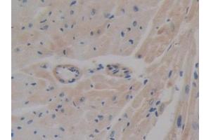Immunohistochemistry (IHC) image for anti-ATP-Binding Cassette, Sub-Family A (ABC1), Member 1 (ABCA1) (AA 1404-1663) antibody (ABIN7433312)
