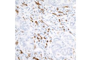 Immunohistochemistry (IHC) image for anti-CD163 (CD163) (AA 850-900) antibody (ABIN7448890) (Rekombinanter CD163 Antikörper  (AA 850-900))