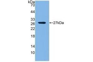 Detection of Recombinant LOXL1, Mouse using Polyclonal Antibody to Lysyl Oxidase Like Protein 1 (LOXL1) (LOXL1 Antikörper  (AA 392-598))