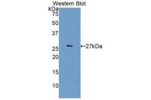 Detection of Recombinant CDK5, Human using Monoclonal Antibody to Cyclin Dependent Kinase 5 (CDK5) (CDK5 Antikörper  (AA 92-273))