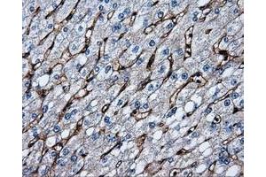 Immunohistochemical staining of paraffin-embedded liver tissue using anti-CD36mouse monoclonal antibody. (CD36 Antikörper)