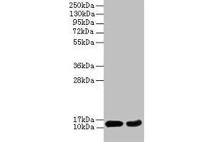Western blot All lanes: EIF4EBP2 antibody at 2 μg/mL Lane 1: Mouse heart tissue Lane 2: NIH/3T3 whole cell lysate Secondary Goat polyclonal to rabbit IgG at 1/10000 dilution Predicted band size: 13 kDa Observed band size: 13 kDa (eIF4EBP2 Antikörper  (AA 1-120))