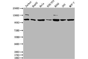 Western Blot Positive WB detected in: Jurkat whole cell lysate, HepG2 whole cell lysate, Hela whole cell lysate, NIH/3T3 whole cell lysate, K562 whole cell lysate, 293 whole cell lysate, MCF-7 whole cell lysate All lanes: PIK3CA antibody at 1:1500 Secondary Goat polyclonal to rabbit IgG at 1/50000 dilution Predicted band size: 125 kDa Observed band size: 110 kDa (Rekombinanter PIK3CA Antikörper  (Catalytic Subunit alpha))