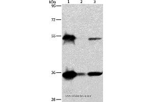 Western blot analysis of Hela, K562 and Raji cell, using BAG1 Polyclonal Antibody at dilution of 1:750 (BAG1 Antikörper)
