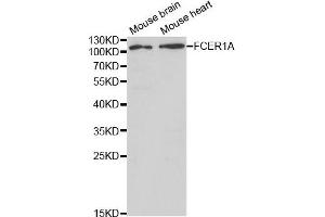 Western blot analysis of extracts of mouse brain and mouse heart cell lines, using FCER1A antibody. (Fc epsilon RI/FCER1A Antikörper)