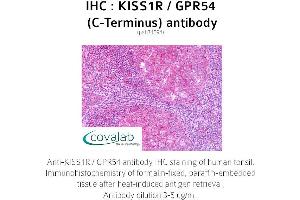 Image no. 1 for anti-KISS1 Receptor (KISS1R) (C-Term) antibody (ABIN1736238)