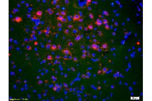 Formalin-fixed and paraffin-embedded rat brain labeled with Anti-ACTH (1-39) Polyclonal Antibody, Unconjugated (ABIN668676) 1:200, overnight at 4°C, The secondary antibody was Goat Anti-Rabbit IgG, Cy3 conjugated used at 1:200 dilution for 40 minutes at 37°C.