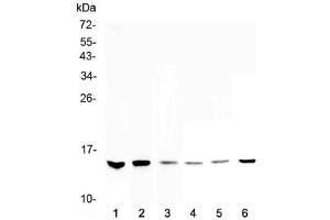 Western blot testing of 1) human HeLa, 2) human MDA-MB-231, 3) human MDA-MB-451, 4) rat thymus, 5) mouse testis and 6) mouse thymus lysate with HE4 antibody at 0. (WFDC2 Antikörper  (AA 31-124))
