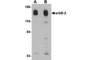 Western Blotting (WB) image for anti-Receptor tyrosine-protein kinase erbB-2 (ErbB2/Her2) (C-Term) antibody (ABIN1030383) (ErbB2/Her2 Antikörper  (C-Term))