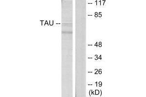 Western blot analysis of extracts from HeLa cells, using Tau (Ab-396) antibody. (MAPT Antikörper  (Ser396))