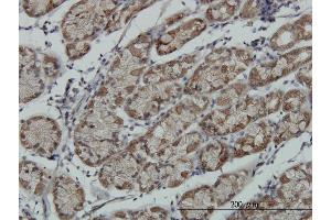 Immunoperoxidase of monoclonal antibody to RPS6KA6 on formalin-fixed paraffin-embedded human stomach. (RPS6KA6 Antikörper  (AA 636-745))