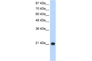 WB Suggested Anti-RPL9 Antibody Titration:  1. (RPL9 Antikörper  (C-Term))