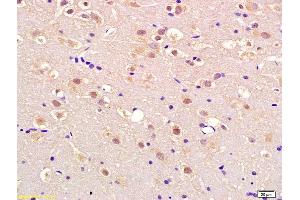 Formalin-fixed and paraffin embedded rat brain labeled with Anti-APEX2 Polyclonal Antibody, Unconjugated (ABIN718481) at 1:200 followed by conjugation to the secondary antibody and DAB staining (APEX2 Antikörper  (AA 301-400))