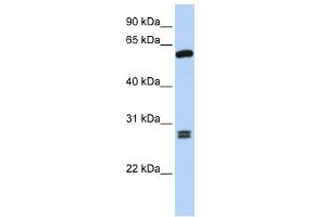 WB Suggested Anti-ACD Antibody Titration: 0. (ACD Antikörper  (C-Term))