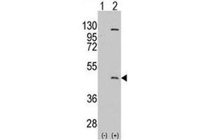 Western blot analysis of PRMT8 antibody and 293 cell lysate either nontransfected (Lane 1) or transiently transfected with the PRMT8 gene (2). (PRMT8 Antikörper  (AA 344-373))