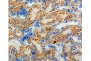 Used in DAB staining on fromalin fixed paraffin-embedded adrenal tissue (CYP11B1 Antikörper  (AA 1-498))