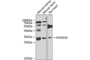 Western blot analysis of extracts of various cell lines, using HOXD10 antibody (ABIN6131767, ABIN6141956, ABIN6141957 and ABIN6223612) at 1:1000 dilution. (HOXD10 Antikörper  (AA 1-240))