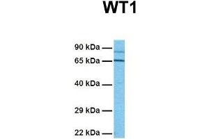 Western Blotting (WB) image for anti-Wilms Tumor 1 (WT1) (Middle Region) antibody (ABIN2780340)