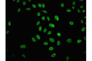 Immunofluorescence (IF) image for anti-Histone Cluster 1, H4a (HIST1H4A) (acLys31) antibody (ABIN7139176)