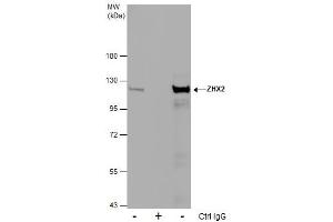 IP Image Immunoprecipitation of ZHX2 protein from MCF-7 whole cell extracts using 5 μg of ZHX2 antibody [C1C3], Western blot analysis was performed using ZHX2 antibody [C1C3], EasyBlot anti-Rabbit IgG  was used as a secondary reagent.