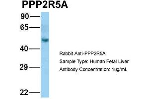 Host: Rabbit Target Name: PPP2R5A Sample Type: Human Fetal Liver Antibody Dilution: 1. (PPP2R5A Antikörper  (N-Term))