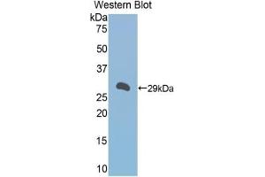Detection of Recombinant a1BG, Mouse using Polyclonal Antibody to Alpha-1-B-Glycoprotein (a1BG) (A1BG Antikörper  (AA 22-219))