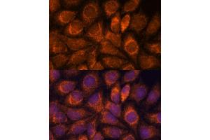Immunofluorescence analysis of HeLa cells using MRPS14 antibody (ABIN7270013) at dilution of 1:100. (RPS14 Antikörper  (AA 1-128))