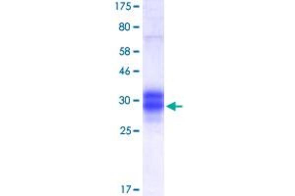 Osteoprotegerin Protein (AA 24-194) (His-DYKDDDDK-Strep II Tag)