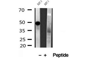 Western blot analysis of extracts of BxPC-3 cells, using PADI2 antibody. (PADI2 Antikörper  (Internal Region))