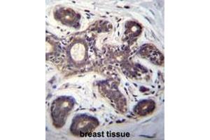 EIF2B1 Antibody (Center) immunohistochemistry analysis in formalin fixed and paraffin embedded human breast tissue followed by peroxidase conjugation of the secondary antibody and DAB staining. (EIF2B1 Antikörper  (Middle Region))