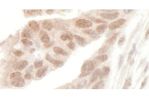 Immunohistochemistry (IHC) image for anti-Protein AF-9 (MLLT3) (AA 250-300) antibody (ABIN7454650)