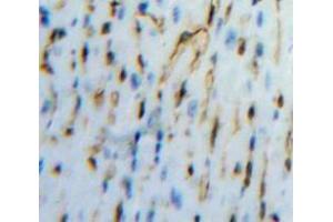 IHC-P analysis of Heart tissue, with DAB staining. (PCOLCE Antikörper  (AA 36-468))