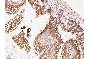 IHC analysis of CDK5 using anti-CDK5 antibody (ABIN6719393). (CDK5 Antikörper  (AA 1-226))